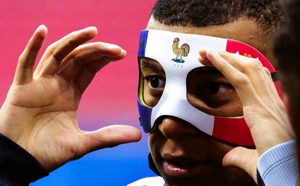 Mbappé y su máscara: Preocupación en Francia para Eurocopa