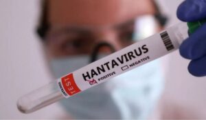 México activa vigilancia epidemiológica por ébola y hantavirus