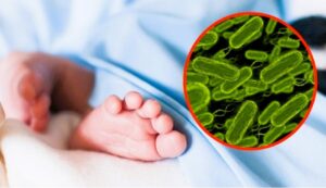 Bebé de 22 días muere tras sufrir infección por “hongo negro”